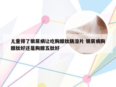 儿童得了银屑病让吃胸腺肽肠溶片 银屑病胸腺肽好还是胸腺五肽好