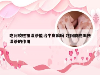 吃阿胶糕祛湿茶能治牛皮癣吗 吃阿胶糕喝祛湿茶的作用