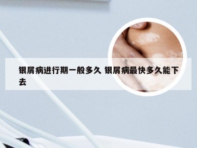 银屑病进行期一般多久 银屑病最快多久能下去