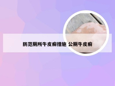 防范厕所牛皮癣措施 公厕牛皮癣