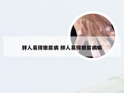 胖人易得银屑病 胖人易得银屑病嘛