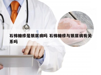 石棉糠疹是银屑病吗 石棉糠疹与银屑病有关系吗