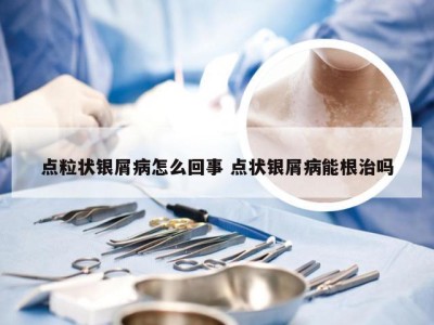 点粒状银屑病怎么回事 点状银屑病能根治吗