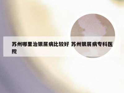 苏州哪里治银屑病比较好 苏州银屑病专科医院