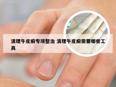 清理牛皮癣专项整治 清理牛皮癣需要哪些工具