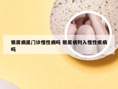 银屑病属门诊慢性病吗 银屑病列入慢性疾病吗