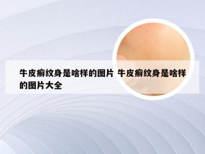 牛皮癣纹身是啥样的图片 牛皮癣纹身是啥样的图片大全