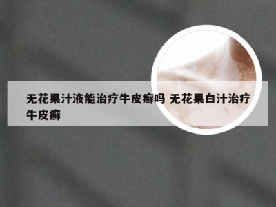 无花果汁液能治疗牛皮癣吗 无花果白汁治疗牛皮癣