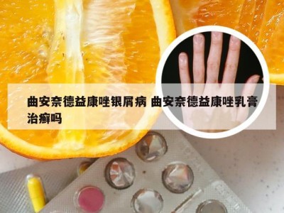 曲安奈德益康唑银屑病 曲安奈德益康唑乳膏治癣吗