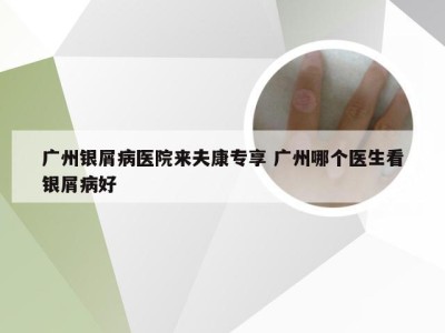 广州银屑病医院来夫康专享 广州哪个医生看银屑病好