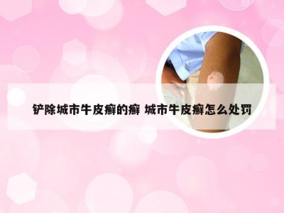 铲除城市牛皮癣的癣 城市牛皮癣怎么处罚