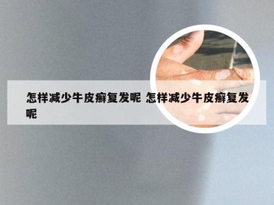 怎样减少牛皮癣复发呢 怎样减少牛皮癣复发呢