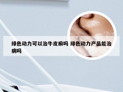 绿色动力可以治牛皮癣吗 绿色动力产品能治病吗