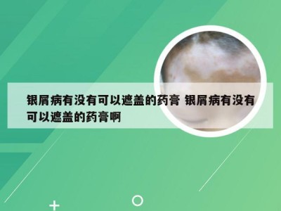 银屑病有没有可以遮盖的药膏 银屑病有没有可以遮盖的药膏啊
