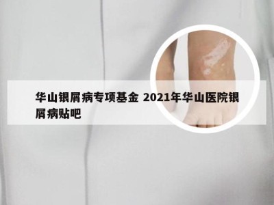 华山银屑病专项基金 2021年华山医院银屑病贴吧