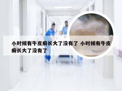 小时候有牛皮癣长大了没有了 小时候有牛皮癣长大了没有了
