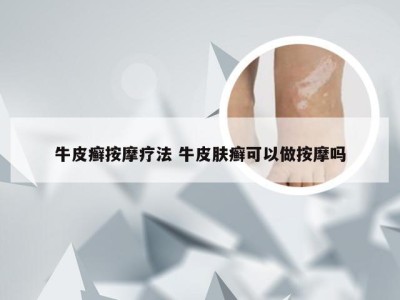 牛皮癣按摩疗法 牛皮肤癣可以做按摩吗