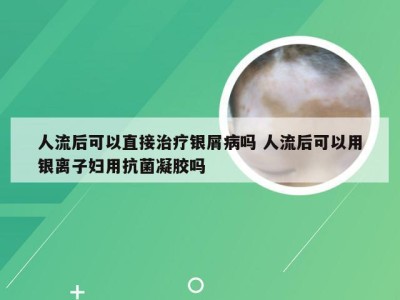 人流后可以直接治疗银屑病吗 人流后可以用银离子妇用抗菌凝胶吗
