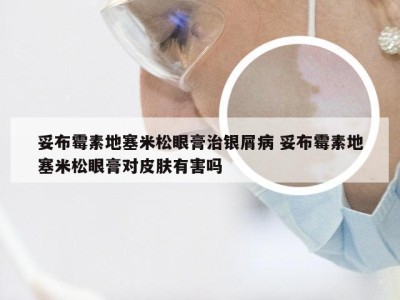 妥布霉素地塞米松眼膏治银屑病 妥布霉素地塞米松眼膏对皮肤有害吗
