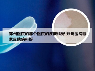 郑州医院的那个医院的皮肤科好 郑州医院哪家皮肤病科好