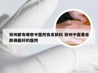 郑州都有哪些中医院有皮肤科 郑州中医看皮肤病最好的医院