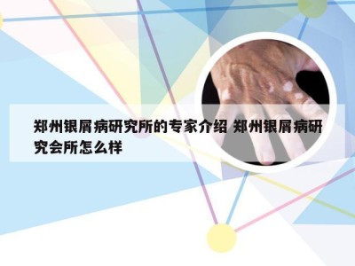 郑州银屑病研究所的专家介绍 郑州银屑病研究会所怎么样