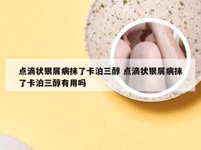点滴状银屑病抹了卡泊三醇 点滴状银屑病抹了卡泊三醇有用吗