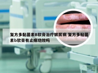 复方多黏菌素B软膏治疗银屑病 复方多粘菌素b软膏有止痒功效吗