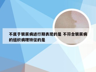 不属于银屑病进行期表现的是 不符合银屑病的组织病理特征的是