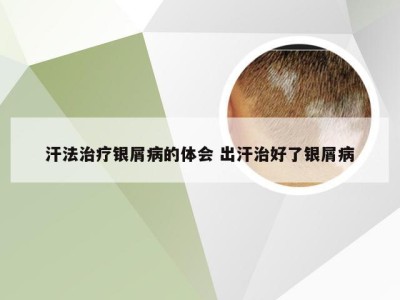汗法治疗银屑病的体会 出汗治好了银屑病