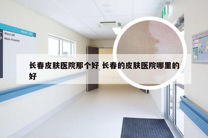 长春皮肤医院那个好 长春的皮肤医院哪里的好