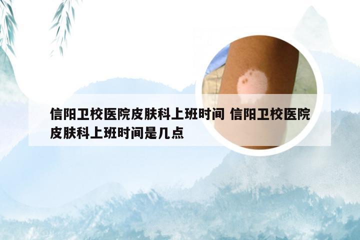信阳卫校医院皮肤科上班时间 信阳卫校医院皮肤科上班时间是几点