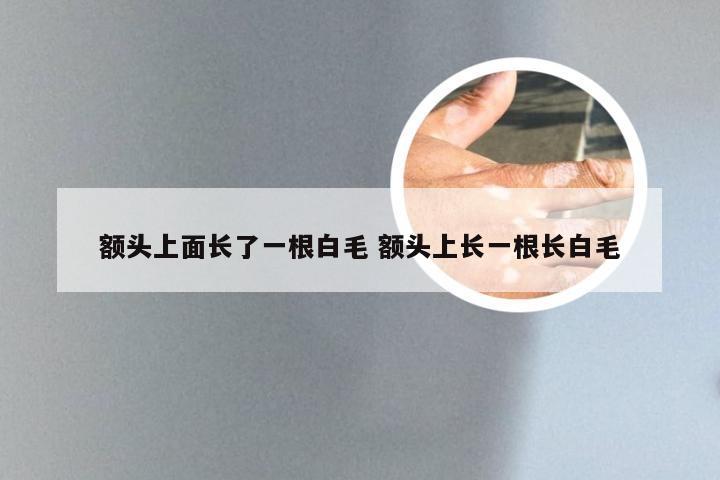 额头上面长了一根白毛 额头上长一根长白毛