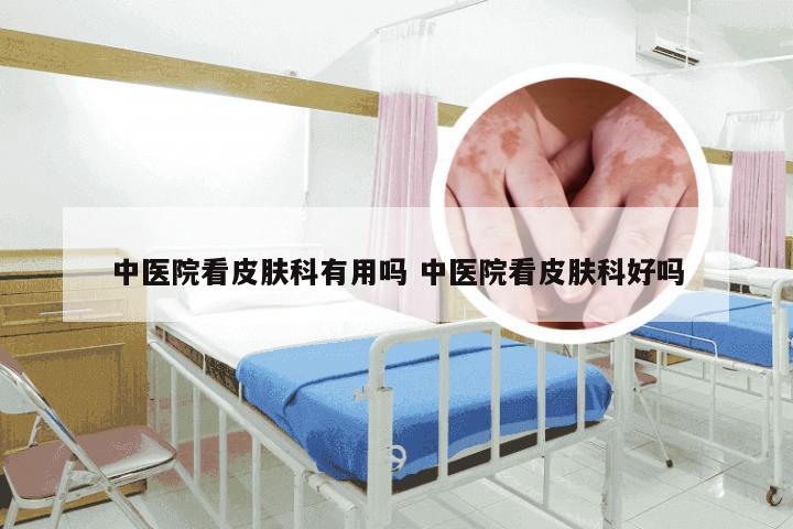 中医院看皮肤科有用吗 中医院看皮肤科好吗