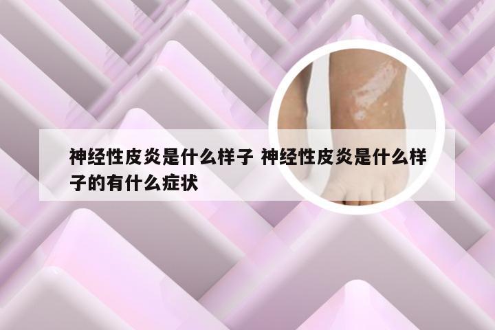 神经性皮炎是什么样子 神经性皮炎是什么样子的有什么症状