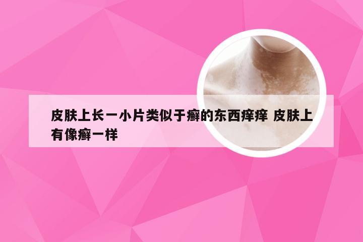 皮肤上长一小片类似于癣的东西痒痒 皮肤上有像癣一样