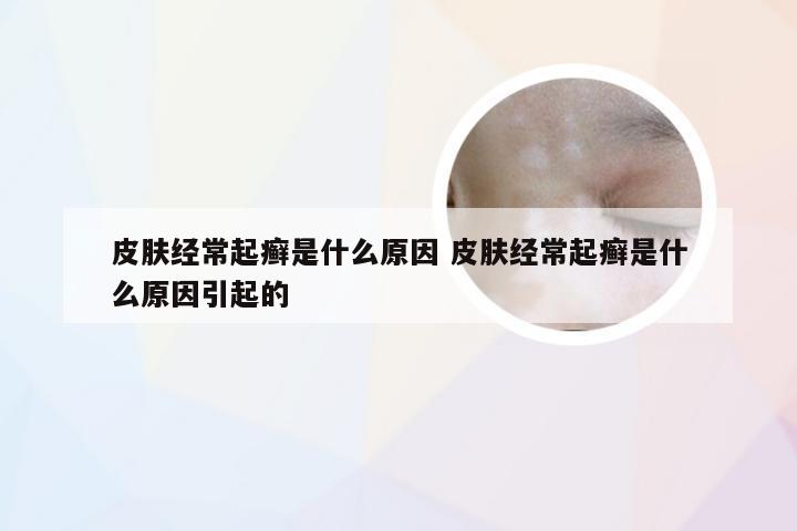 皮肤经常起癣是什么原因 皮肤经常起癣是什么原因引起的