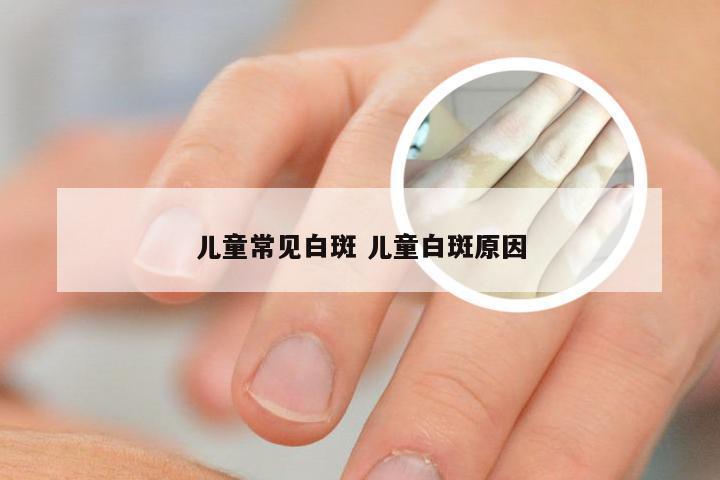 儿童常见白斑 儿童白斑原因
