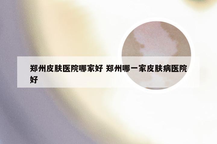 郑州皮肤医院哪家好 郑州哪一家皮肤病医院好