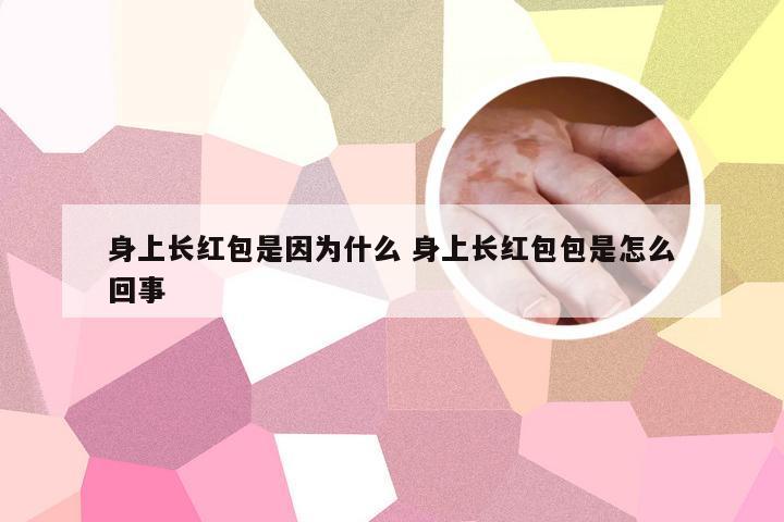 身上长红包是因为什么 身上长红包包是怎么回事