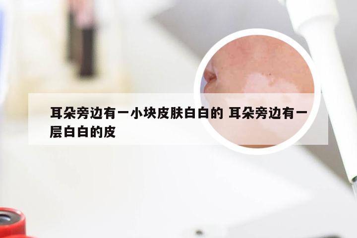 耳朵旁边有一小块皮肤白白的 耳朵旁边有一层白白的皮