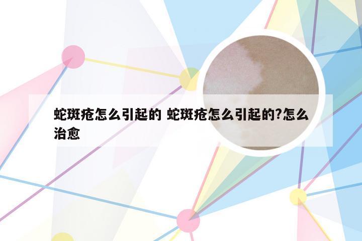 蛇斑疮怎么引起的 蛇斑疮怎么引起的?怎么治愈
