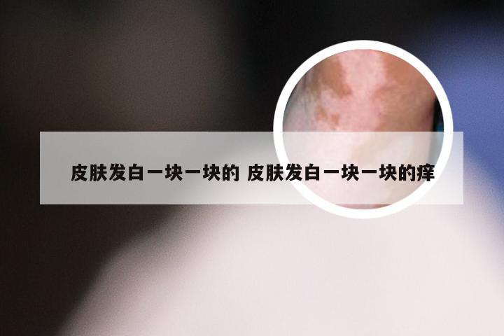 皮肤发白一块一块的 皮肤发白一块一块的痒
