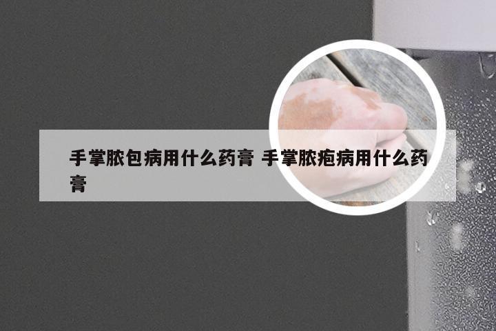 手掌脓包病用什么药膏 手掌脓疱病用什么药膏