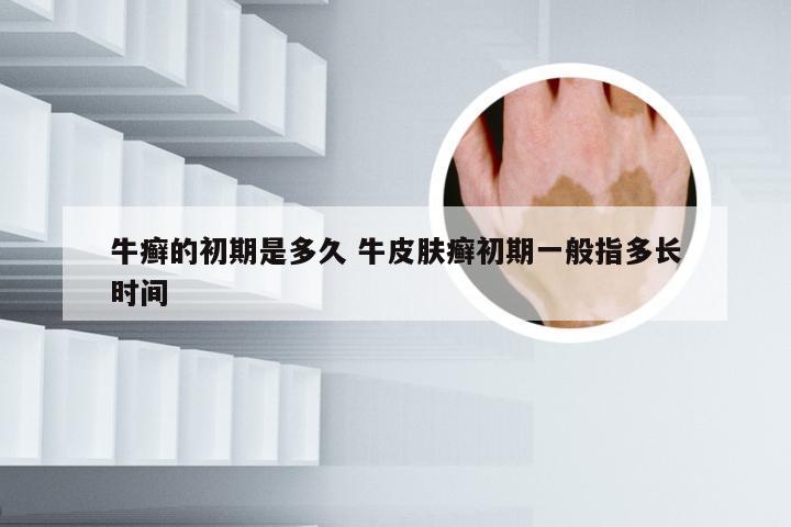 牛癣的初期是多久 牛皮肤癣初期一般指多长时间