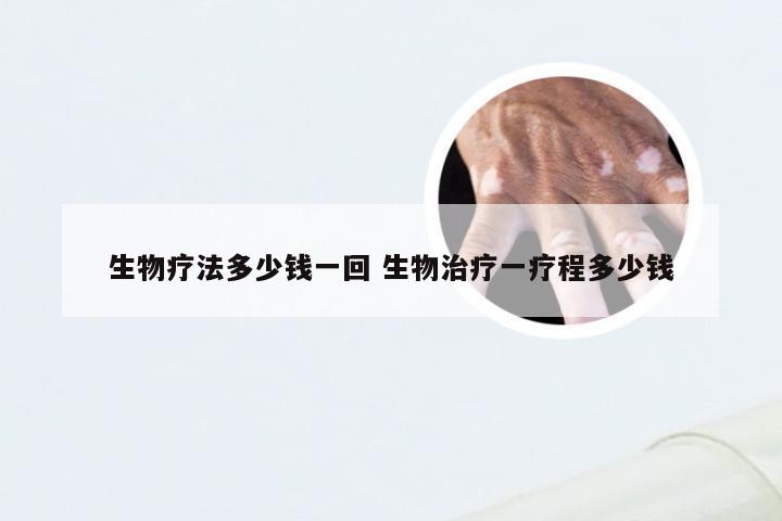 生物疗法多少钱一回 生物治疗一疗程多少钱