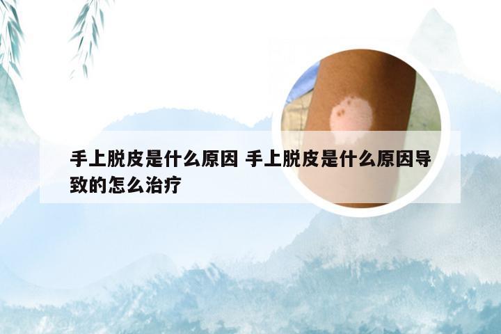 手上脱皮是什么原因 手上脱皮是什么原因导致的怎么治疗