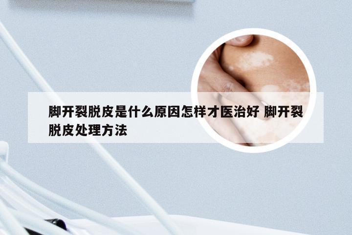 脚开裂脱皮是什么原因怎样才医治好 脚开裂脱皮处理方法