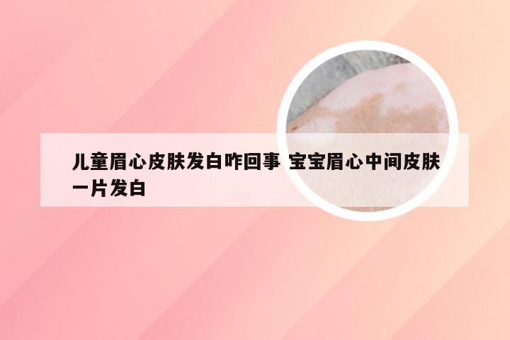 儿童眉心皮肤发白咋回事 宝宝眉心中间皮肤一片发白