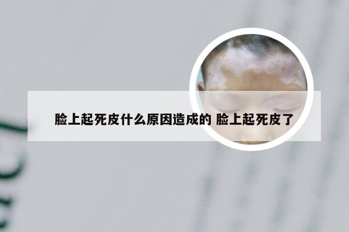 脸上起死皮什么原因造成的 脸上起死皮了